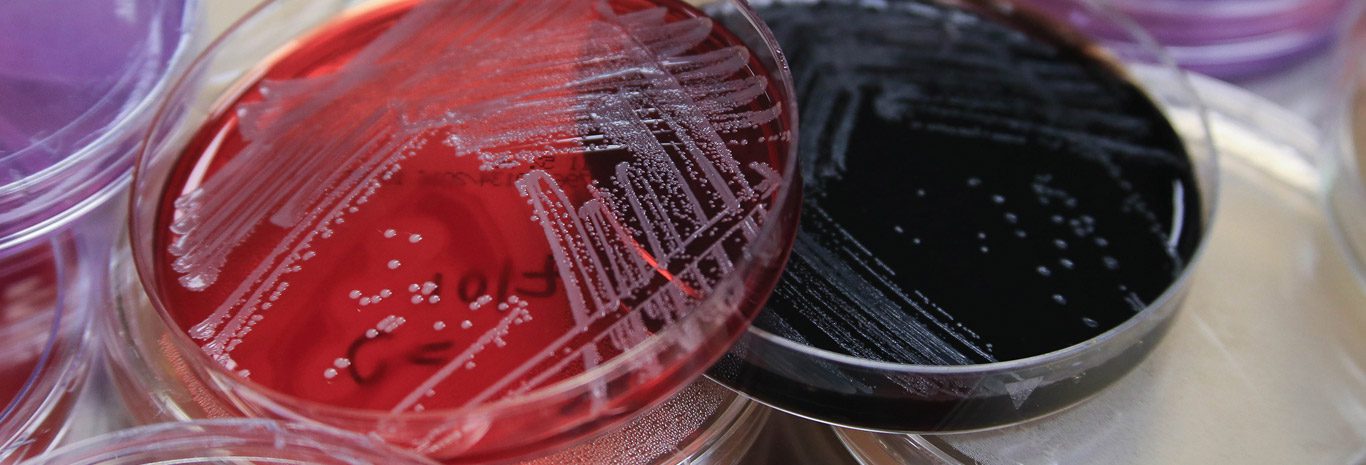 Learn About Our Industry Leading Food Safety Testing FSNS