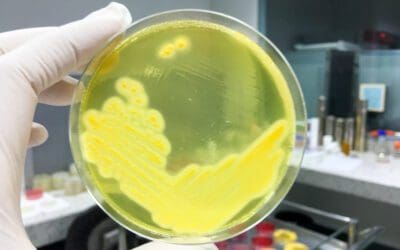 Microbial Strain Typing: A Powerful Tool for Ensuring Food Safety