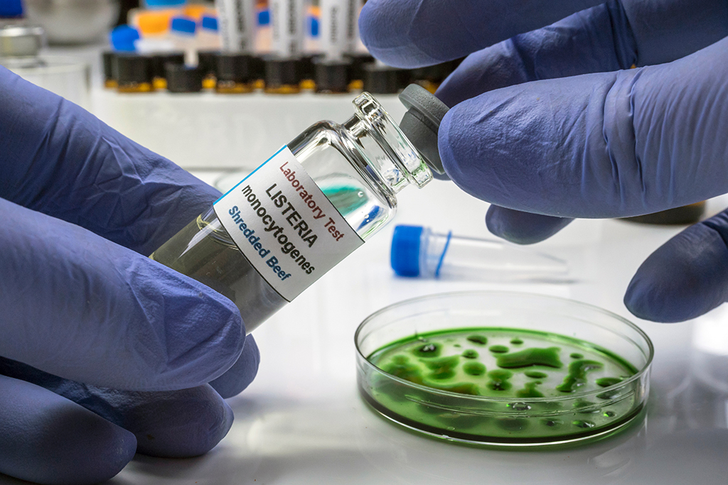 Listeria monocytogenes testing using a petri dish in a food testing lab. 
