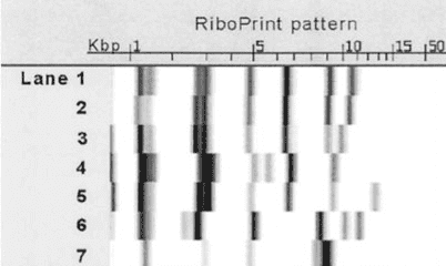 Ribotyping barcode from microbial strain typing.  