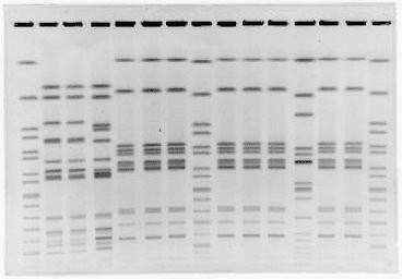 Pulsed-Field Gel Electrophoresis (PFGE) barcode from microbial strain typing.
